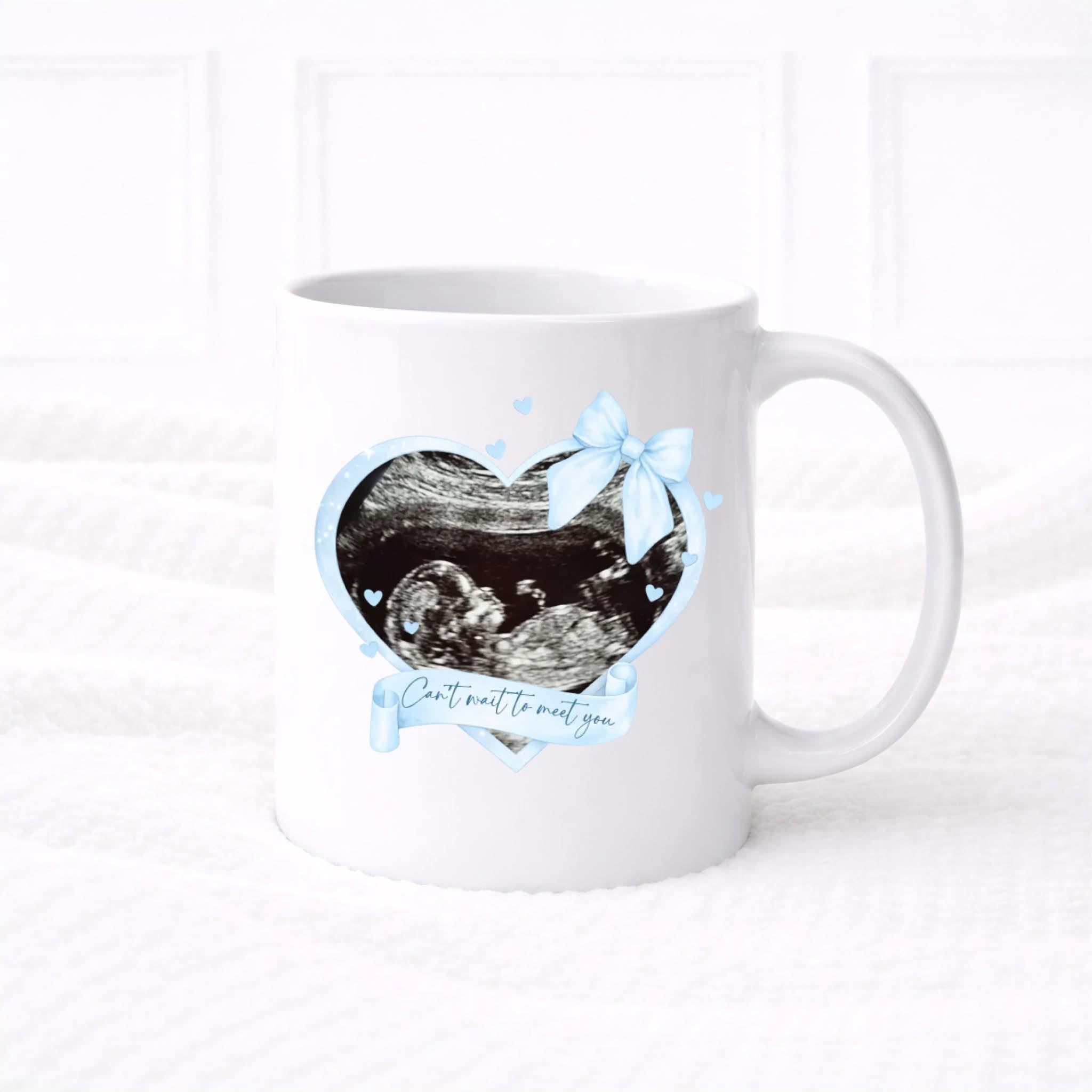SCAN PHOTO MUGS (multiple colours)
